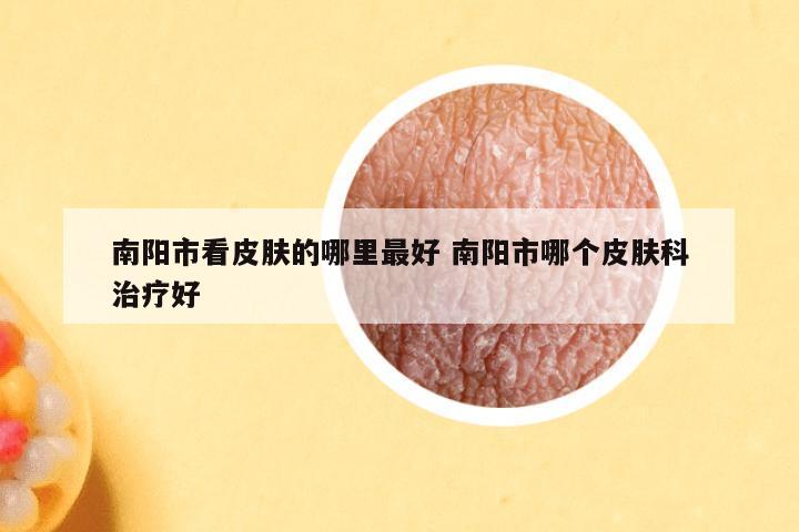 南阳市看皮肤的哪里最好 南阳市哪个皮肤科治疗好
