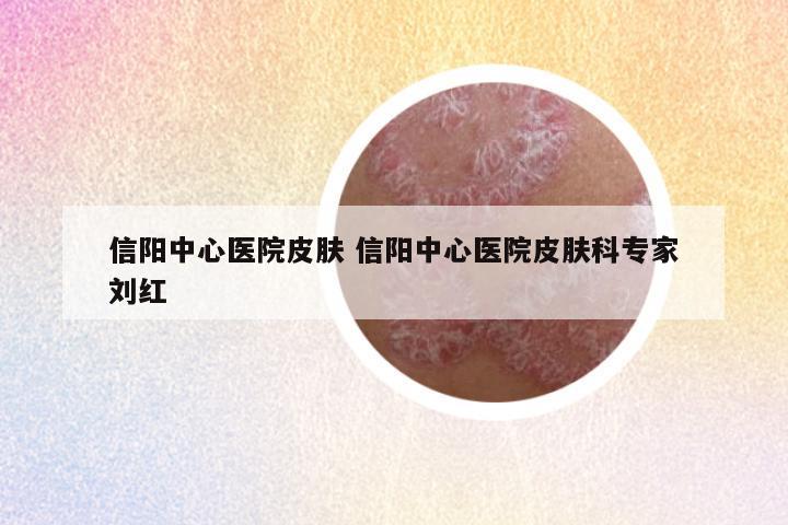 信阳中心医院皮肤 信阳中心医院皮肤科专家刘红