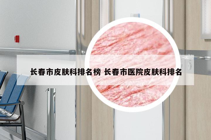 长春市皮肤科排名榜 长春市医院皮肤科排名