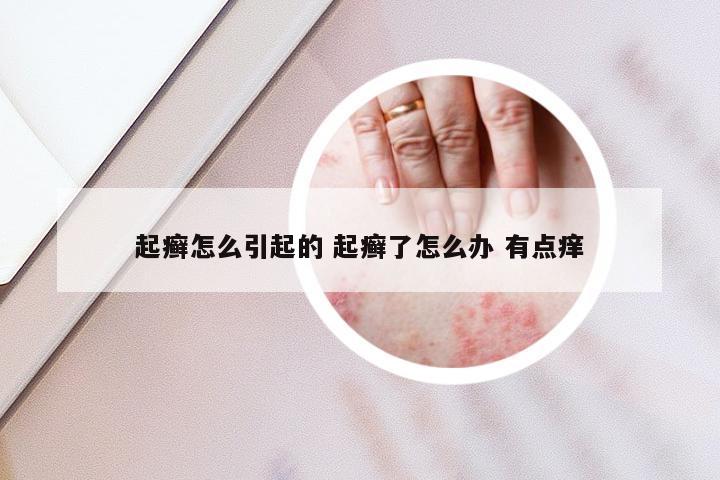 起癣怎么引起的 起癣了怎么办 有点痒