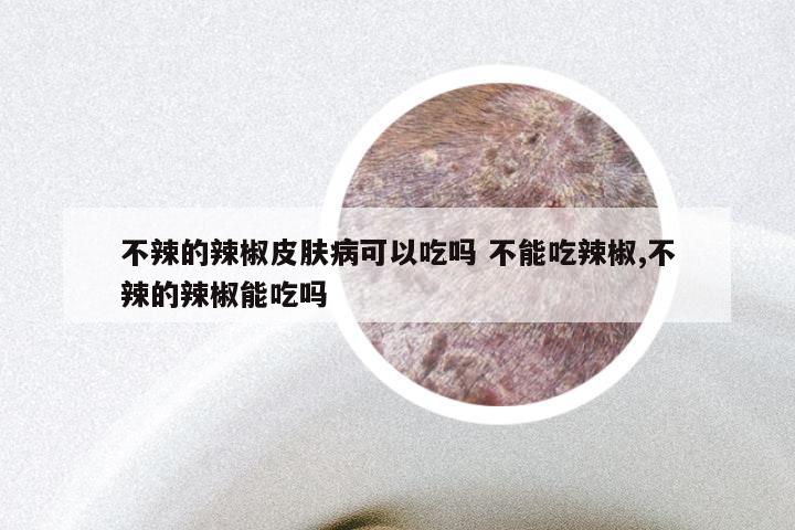 不辣的辣椒皮肤病可以吃吗 不能吃辣椒,不辣的辣椒能吃吗