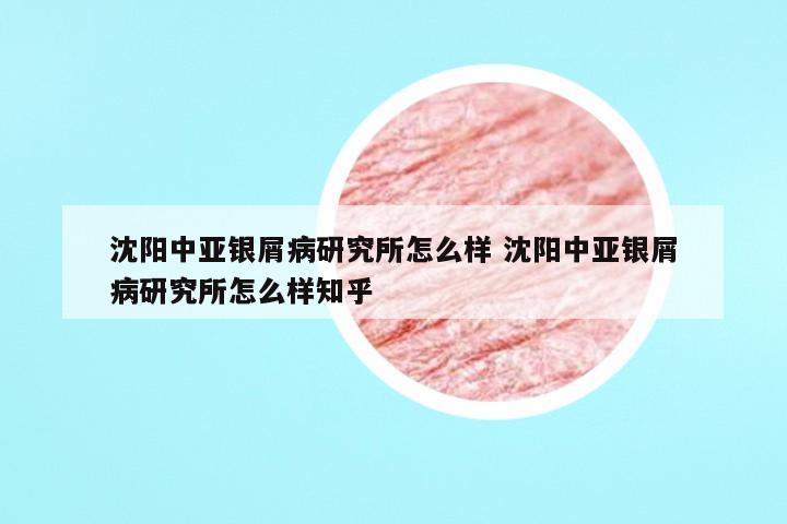 沈阳中亚银屑病研究所怎么样 沈阳中亚银屑病研究所怎么样知乎
