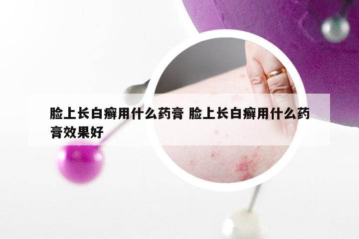 脸上长白癣用什么药膏 脸上长白癣用什么药膏效果好
