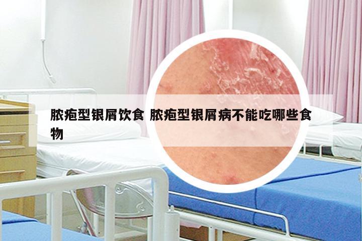 脓疱型银屑饮食 脓疱型银屑病不能吃哪些食物