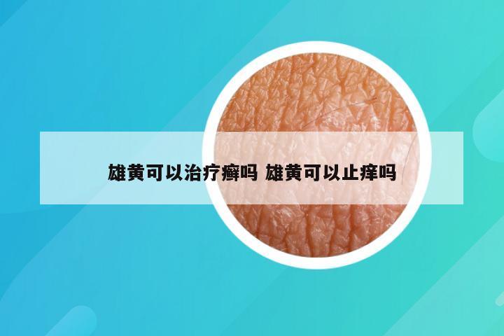 雄黄可以治疗癣吗 雄黄可以止痒吗