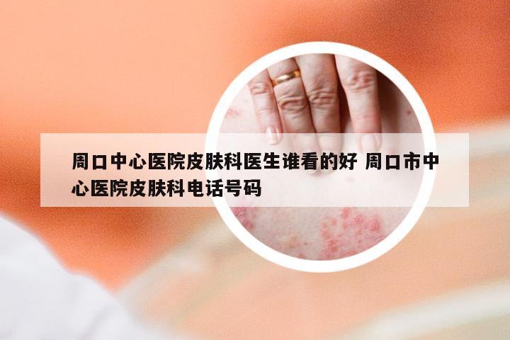 周口中心医院皮肤科医生谁看的好 周口市中心医院皮肤科电话号码