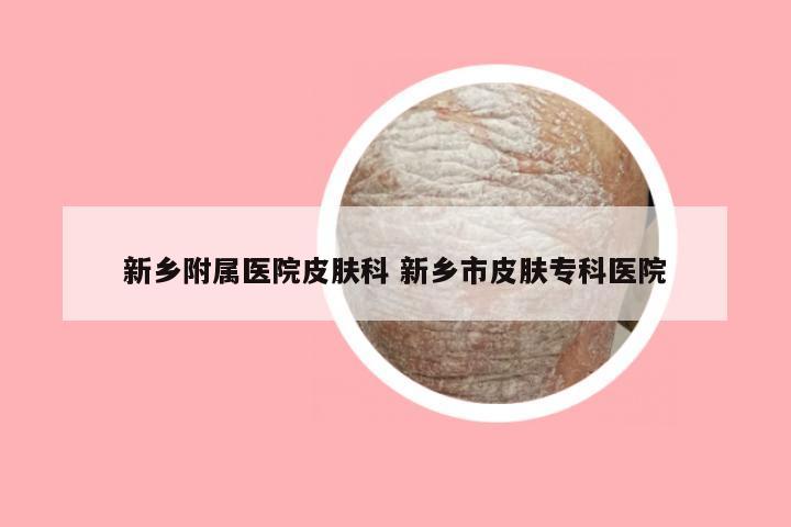 新乡附属医院皮肤科 新乡市皮肤专科医院