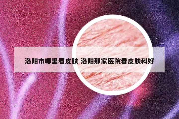 洛阳市哪里看皮肤 洛阳那家医院看皮肤科好