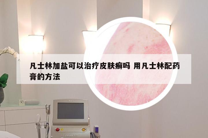 凡士林加盐可以治疗皮肤癣吗 用凡士林配药膏的方法