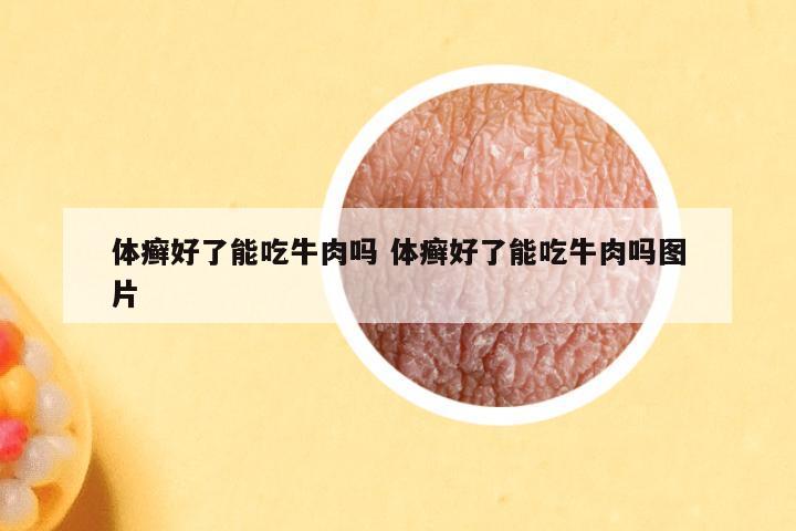 体癣好了能吃牛肉吗 体癣好了能吃牛肉吗图片