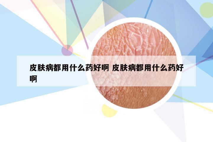 皮肤病都用什么药好啊 皮肤病都用什么药好啊