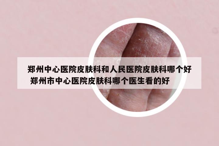 郑州中心医院皮肤科和人民医院皮肤科哪个好 郑州市中心医院皮肤科哪个医生看的好