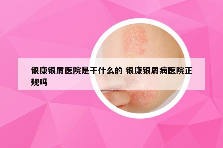 银康银屑医院是干什么的 银康银屑病医院正规吗