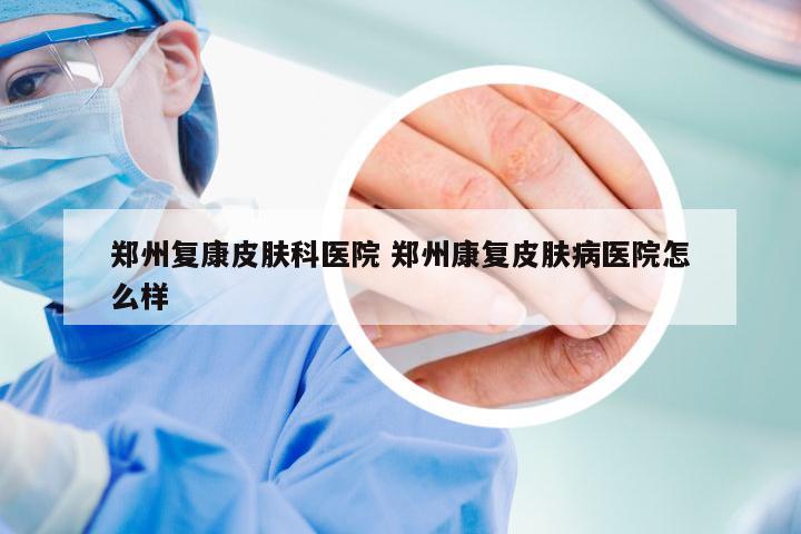 郑州复康皮肤科医院 郑州康复皮肤病医院怎么样