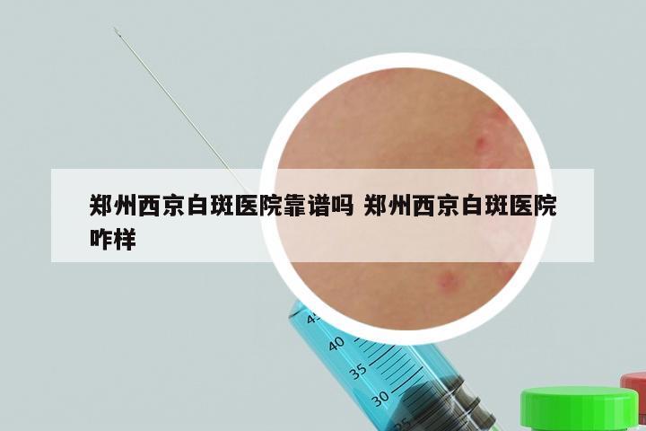 郑州西京白斑医院靠谱吗 郑州西京白斑医院咋样
