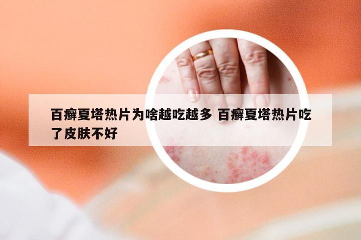 百癣夏塔热片为啥越吃越多 百癣夏塔热片吃了皮肤不好
