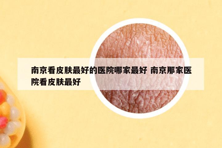 南京看皮肤最好的医院哪家最好 南京那家医院看皮肤最好