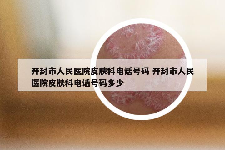 开封市人民医院皮肤科电话号码 开封市人民医院皮肤科电话号码多少