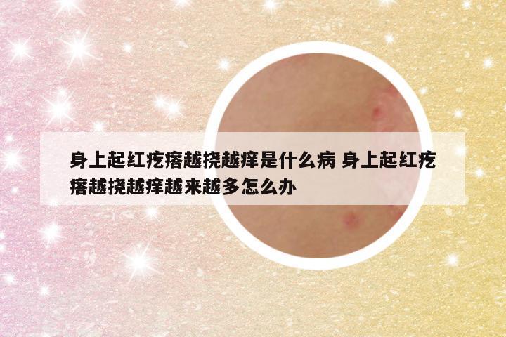 身上起红疙瘩越挠越痒是什么病 身上起红疙瘩越挠越痒越来越多怎么办