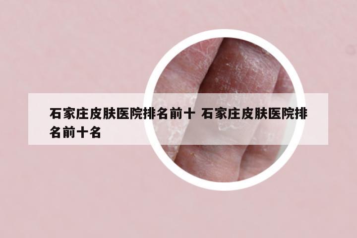 石家庄皮肤医院排名前十 石家庄皮肤医院排名前十名