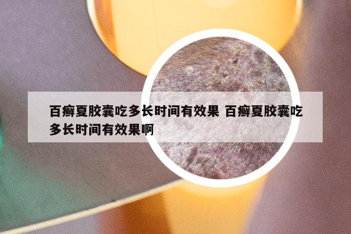 百癣夏胶囊吃多长时间有效果 百癣夏胶囊吃多长时间有效果啊