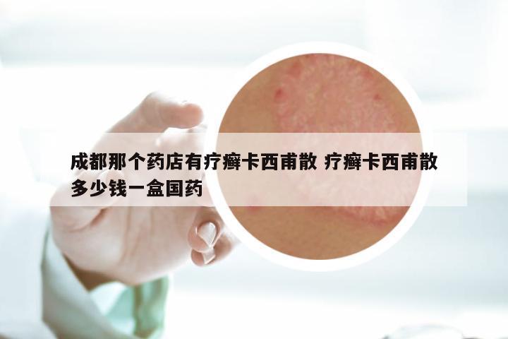 成都那个药店有疗癣卡西甫散 疗癣卡西甫散多少钱一盒国药