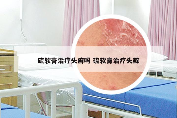 硫软膏治疗头癣吗 硫软膏治疗头藓