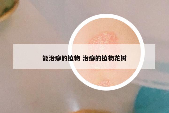 能治癣的植物 治癣的植物花树