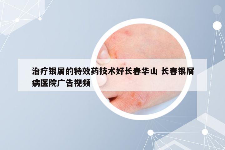 治疗银屑的特效药技术好长春华山 长春银屑病医院广告视频