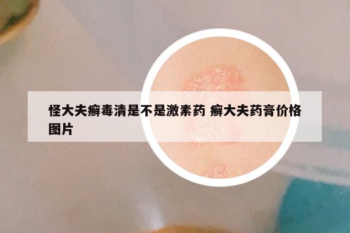 怪大夫癣毒清是不是激素药 癣大夫药膏价格图片