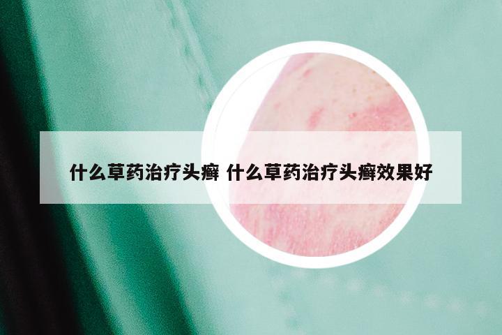 什么草药治疗头癣 什么草药治疗头癣效果好