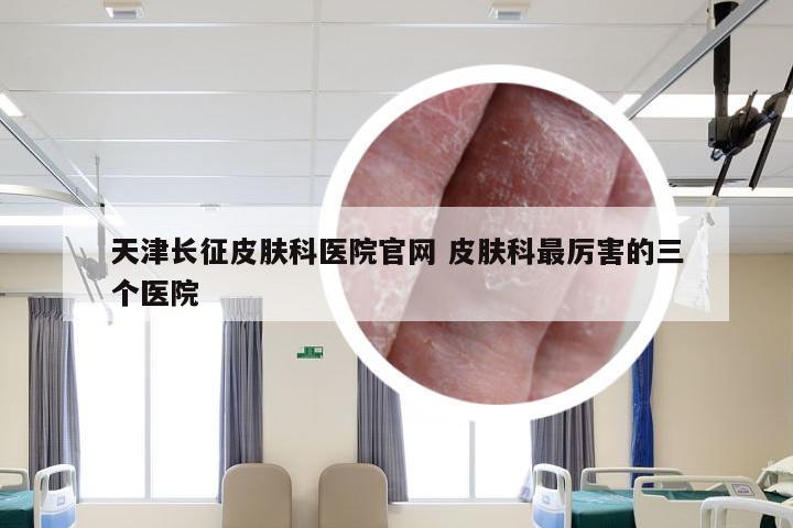 天津长征皮肤科医院官网 皮肤科最厉害的三个医院