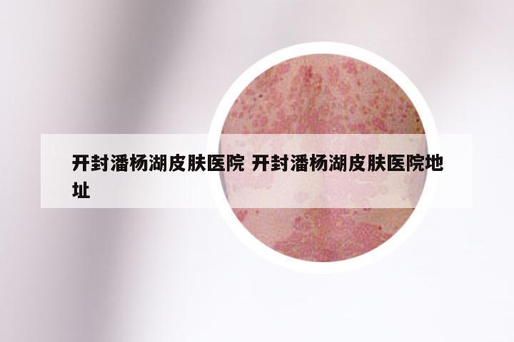 开封潘杨湖皮肤医院 开封潘杨湖皮肤医院地址