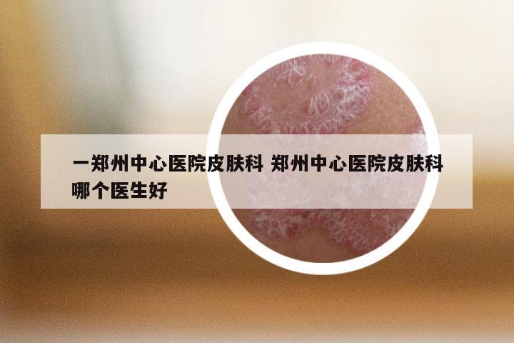 一郑州中心医院皮肤科 郑州中心医院皮肤科哪个医生好