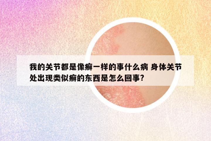 我的关节都是像癣一样的事什么病 身体关节处出现类似癣的东西是怎么回事?