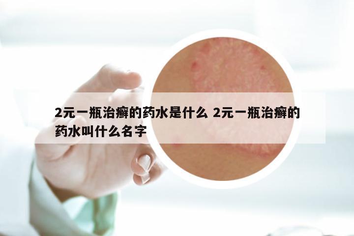 2元一瓶治癣的药水是什么 2元一瓶治癣的药水叫什么名字