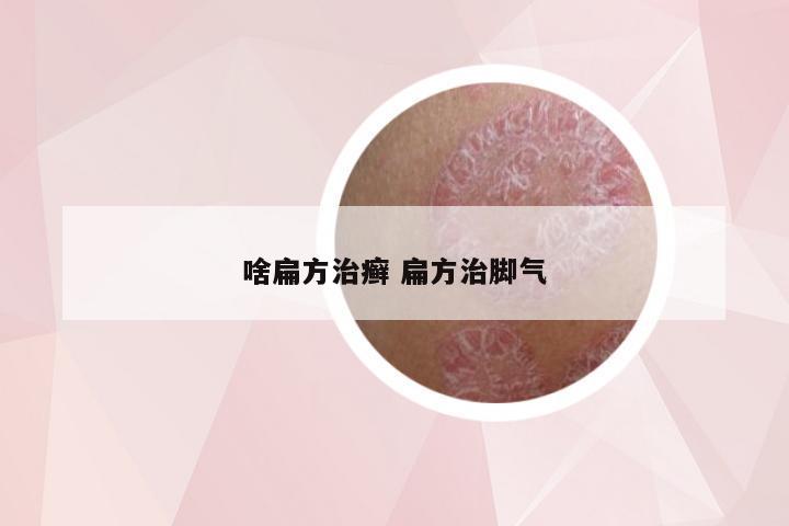 啥扁方治癣 扁方治脚气