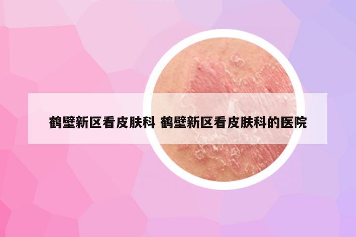 鹤壁新区看皮肤科 鹤壁新区看皮肤科的医院