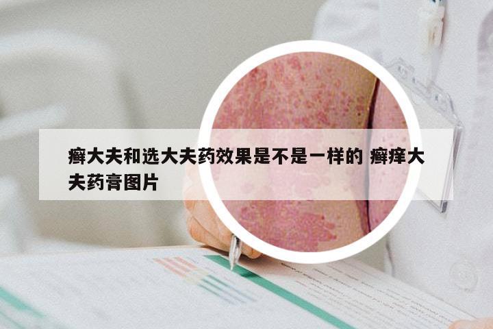 癣大夫和选大夫药效果是不是一样的 癣痒大夫药膏图片