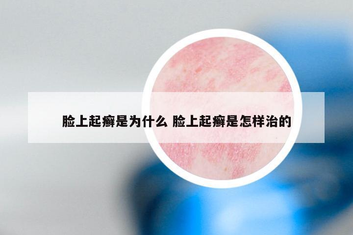 脸上起癣是为什么 脸上起癣是怎样治的
