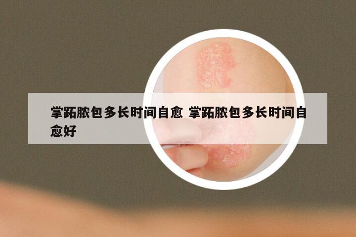 掌跖脓包多长时间自愈 掌跖脓包多长时间自愈好