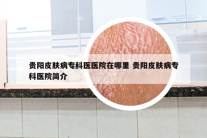 贵阳皮肤病专科医医院在哪里 贵阳皮肤病专科医院简介