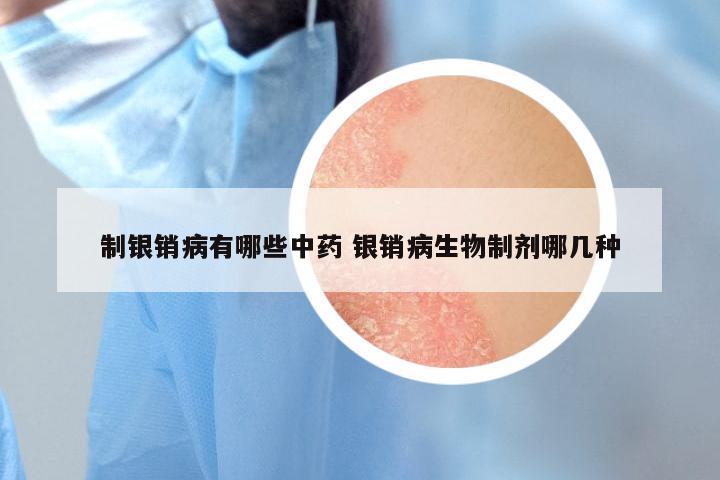 制银销病有哪些中药 银销病生物制剂哪几种