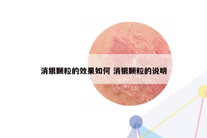 消银颗粒的效果如何 消银颗粒的说明