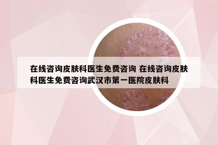 在线咨询皮肤科医生免费咨询 在线咨询皮肤科医生免费咨询武汉市第一医院皮肤科