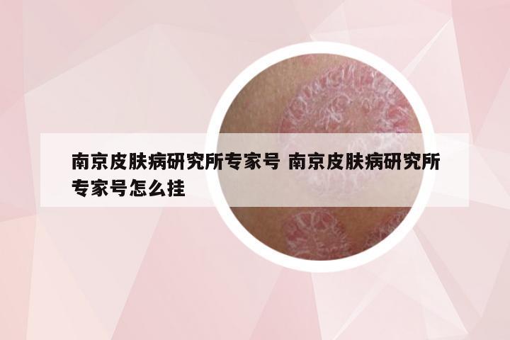 南京皮肤病研究所专家号 南京皮肤病研究所专家号怎么挂
