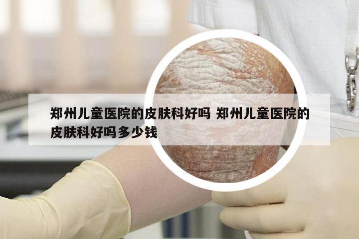 郑州儿童医院的皮肤科好吗 郑州儿童医院的皮肤科好吗多少钱