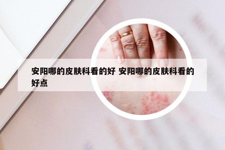 安阳哪的皮肤科看的好 安阳哪的皮肤科看的好点