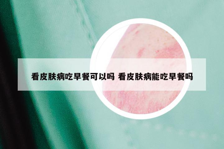 看皮肤病吃早餐可以吗 看皮肤病能吃早餐吗