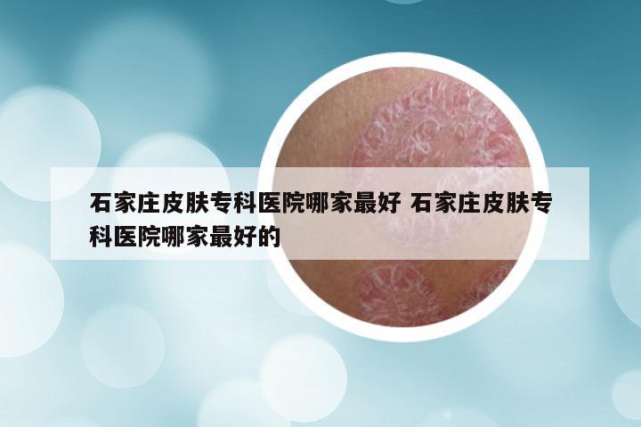 石家庄皮肤专科医院哪家最好 石家庄皮肤专科医院哪家最好的
